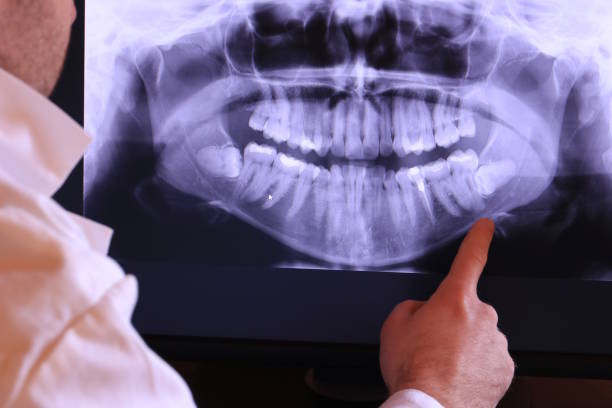 Best Emergency Care for Gum Disease in Manchester, IA